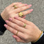 Anillo de abrazo